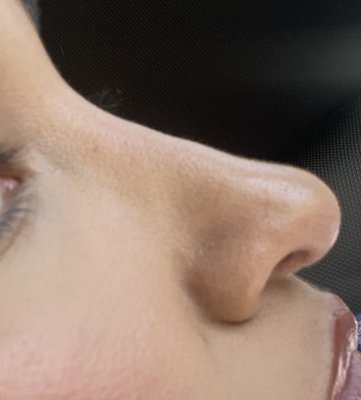 Shah Aesthetic Surgery - Rhinoplasty and Facelift Specialist by null