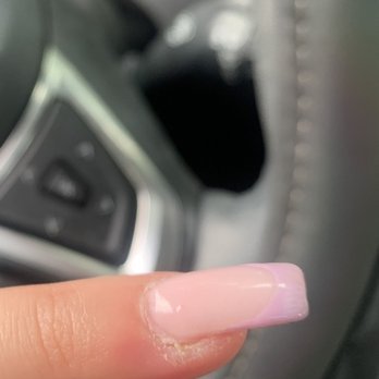 Merry Nails & Spa - Cuticle infection - Nail Salons Near Me - Tracy, California