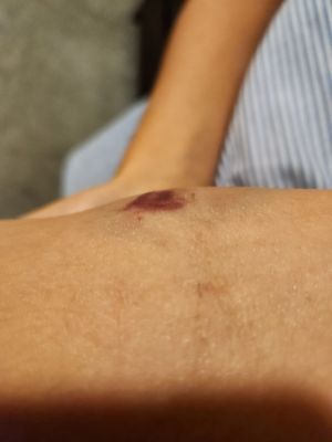 Kimberly M Bloomcamp, APN - NorthShore University HealthSystem-NorthShore Medical Group