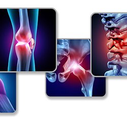 Pain Care Providers - Regenerative therapy would offer best results in mild to moderate case to reverse or slow down degenerative changes.