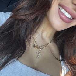 George Georgaklis, DDS - After photo
