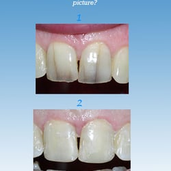 Robert J Funk, DDS - Take the Smile By Funk Challenge!