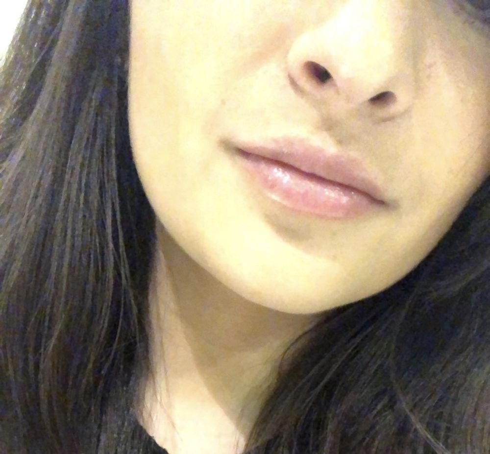 MODERNE MEDICAL ALLISON WOODWORTH, RN, MSN, FNPC Updated September