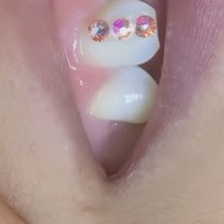 Teeth Gems - 3 bling