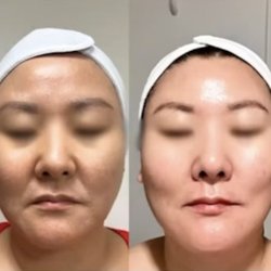 Bella Diosa Beauty - Results from our timeless peel. Instantly brightens and tightens
