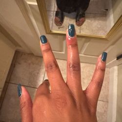 Pro Top Nails - Infected nails