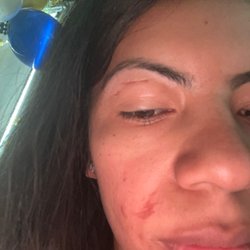 Lash,Wax & Relax - I also did my upper lip. I don't know how this lady burned my skin around it either... now this is upsetting.