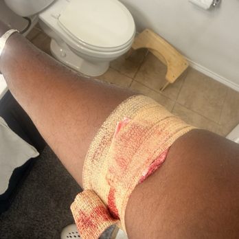 BioLife Plasma Services - A bad wrap, bleed through and damaged my clothes - Blood & Plasma Donation Centers Near Me - Austin, Texas
