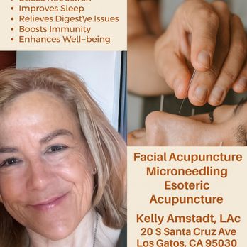 Sonrisa Acupuncture - Acupuncture Near Me - Los Gatos, California Sonrisa Acupuncture - Acupuncture Near Me - Los Gatos, California