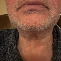 Scraggly looking 2 week old beard. Getting a straight razor shave from Mak. First time getting a barber shave. Scraggly looking 2 week old beard. Getting a straight razor shave from Mak. First time getting a barber shave.