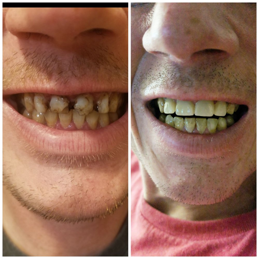 COMFORT DENTAL 25 Reviews 2010 Juan Tabo Blvd NE, Albuquerque, NM