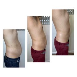 Build A Bitch Aesthetics - 2 sessions of cavitation
