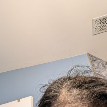 Ken Bailey Hair Studio - Severe hair thinning - Hair Salons Near Me - Atlanta, Georgia Ken Bailey Hair Studio - Severe hair thinning - Hair Salons Near Me - Atlanta, Georgia