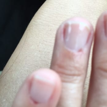 Great Nails & Spa - 2 cuts because the guy was going so fast - Nail Salons Near Me - Austin, Texas Great Nails & Spa - 2 cuts because the guy was going so fast - Nail Salons Near Me - Austin, Texas