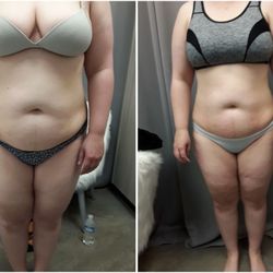 Skinny Glow Lipo