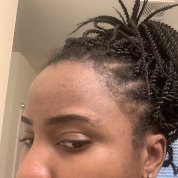 Nicole's Beauty Lounge - Swelling and scratched above my eyebrows for repeated waxing applications - Skin Care Near Me - Atlanta, Georgia Nicole's Beauty Lounge - Swelling and scratched above my eyebrows for repeated waxing applications - Skin Care Near Me - Atlanta, Georgia