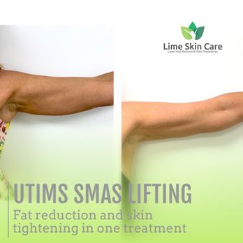 Lime Skin Care - Utims Smas Lifting - Medical Spas Near Me - Hollywood, Florida Lime Skin Care - Utims Smas Lifting - Medical Spas Near Me - Hollywood, Florida