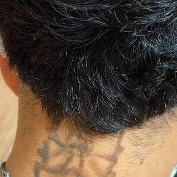 Reset Tattoo Removal - Tattoo Removal Near Me - Las Vegas, Nevada Reset Tattoo Removal - Tattoo Removal Near Me - Las Vegas, Nevada