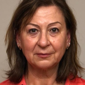 Hudson Facial Plastic Surgery - two weeks before the surgery - Plastic Surgeons Near Me - Chicago, Illinois