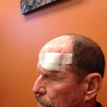 Camelback Dermatology & Skin Surgery - After the cut waiting for the results. - Dermatologists Near Me - Phoenix, Arizona