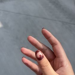 Excel Nails - thumb nail after gel peeled off