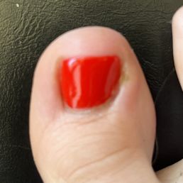 Infected side of toe where nail tech cut me