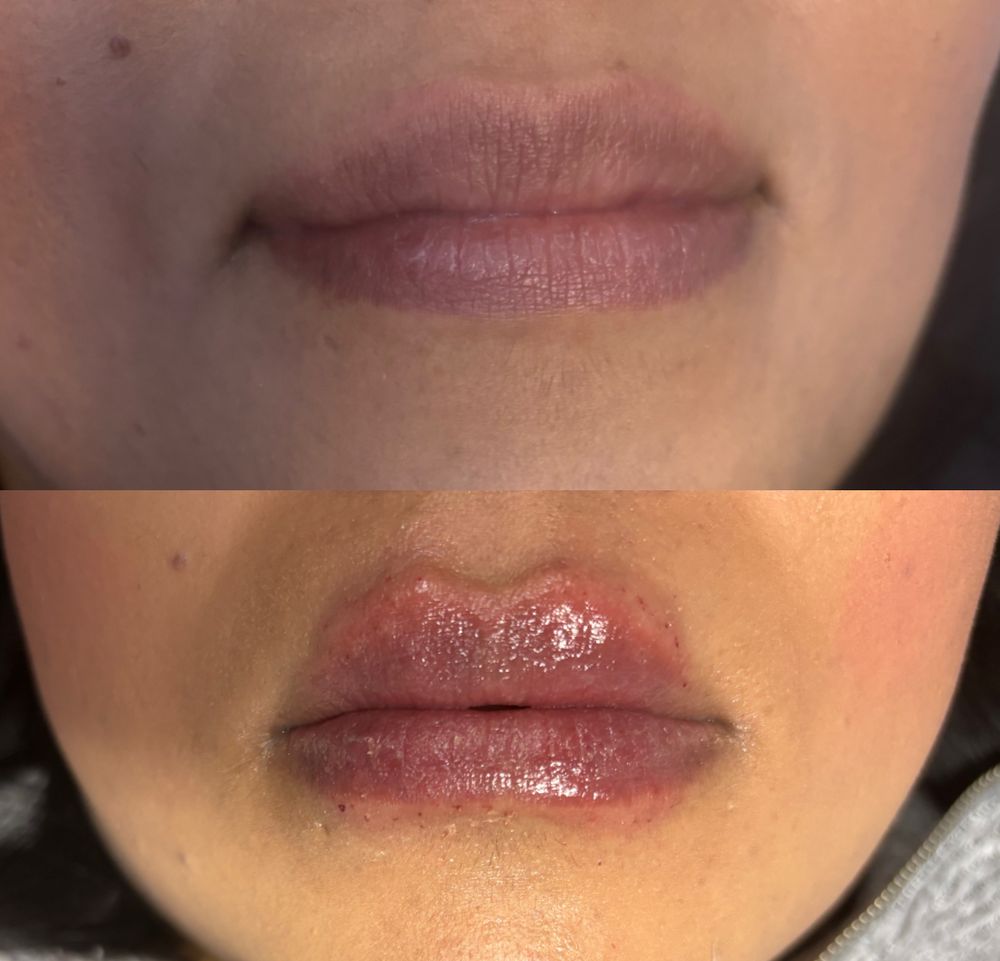 Matsunaga Loves Logo