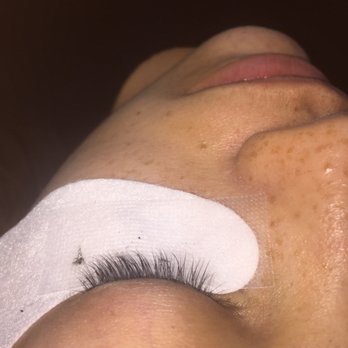 NY Waxing Center - Before - Hair Removal Near Me - N Miami Beach, Florida
