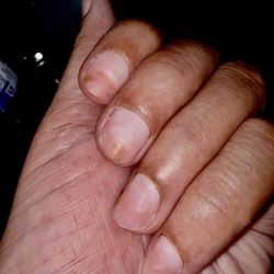 Villa Nails - The mold on my nails