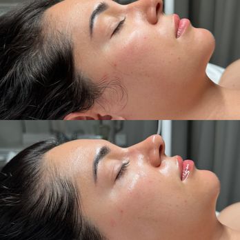 Earnest Esthetics - Estheticians Near Me - San Mateo, California Earnest Esthetics - Estheticians Near Me - San Mateo, California