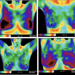 Whole Body Healing Center - Perfect breast images