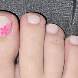 KSC pedi. Skin tore up, big nail wrong design and shape and cut to short. KSC pedi. Skin tore up, big nail wrong design and shape and cut to short.