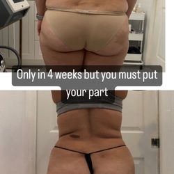 Body By Maggie Spa - Mommy make over treatment non invasive
