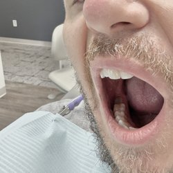Nordonia Dental Group - Crown removal