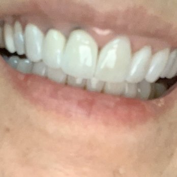 Richard P Kinsel, DDS - General Dentistry Near Me - San Mateo, California Richard P Kinsel, DDS - General Dentistry Near Me - San Mateo, California