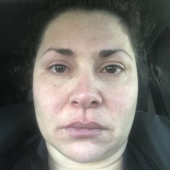 Darryl L Morris, DDS - Me crying after Dr Morris yelled at me after he REFUSED MY DAUGHTER HER SURGERY!!! - Oral Surgeons Near Me - Menifee, California Darryl L Morris, DDS - Me crying after Dr Morris yelled at me after he REFUSED MY DAUGHTER HER SURGERY!!! - Oral Surgeons Near Me - Menifee, California