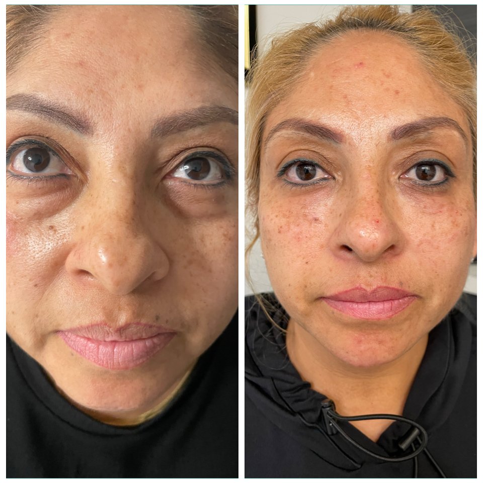 MEDICAL WEIGHT LOSS AND BEAUTY 36 Photos & 13 Reviews 24 E Colorado