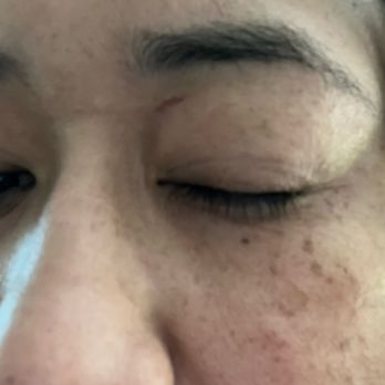 Nail Fever - After my left eye - Nail Salons Near Me - Antioch, California