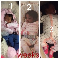 Rakhee Patel, MD - Thank you again for keeping my bundle of joy safe through pregnancy and delivery I'm so blessed for her and you McKenzie 1/24/2017