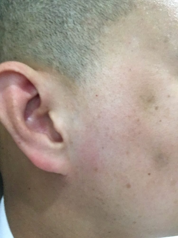 NUSILK MEDICAL SPA 24 Photos & 75 Reviews 105 N Ave, San