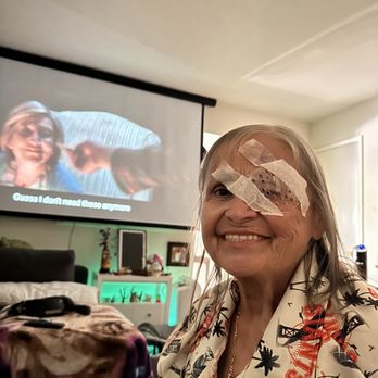 Robin Kuriakose, MD - My eye surgery before and after - Laser Eye Surgery/Lasik Near Me - Hayward, California Robin Kuriakose, MD - My eye surgery before and after - Laser Eye Surgery/Lasik Near Me - Hayward, California