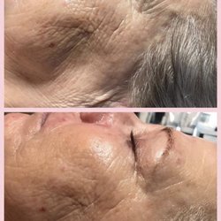 Skintuition Studio - This is an after nano needling glow!