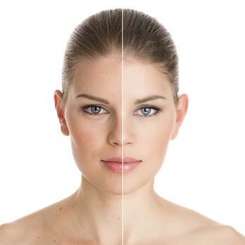 Beauty Kingdom - Laser Hair Removal Near Me - Sterling Heights, Michigan Beauty Kingdom - Laser Hair Removal Near Me - Sterling Heights, Michigan