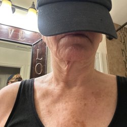 S K Clinic - Goose neck