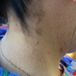 More dye on the neck.
