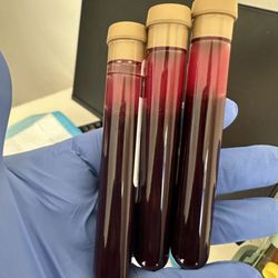 Gateway Mobile Phlebotomy