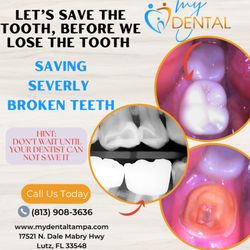 MyDental - Save teeth with dental crowns