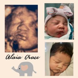 Sneak Peek Keepsake Ultrasound