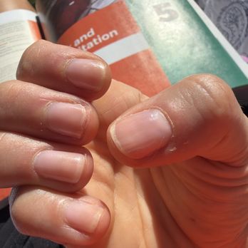 Iconic Nails Lounge - My nails after just 6 days with gel polish. I choose a natural color because I can't have anything else for my job. - Nail Salons Near Me - Issaquah, Washington Iconic Nails Lounge - My nails after just 6 days with gel polish. I choose a natural color because I can't have anything else for my job. - Nail Salons Near Me - Issaquah, Washington