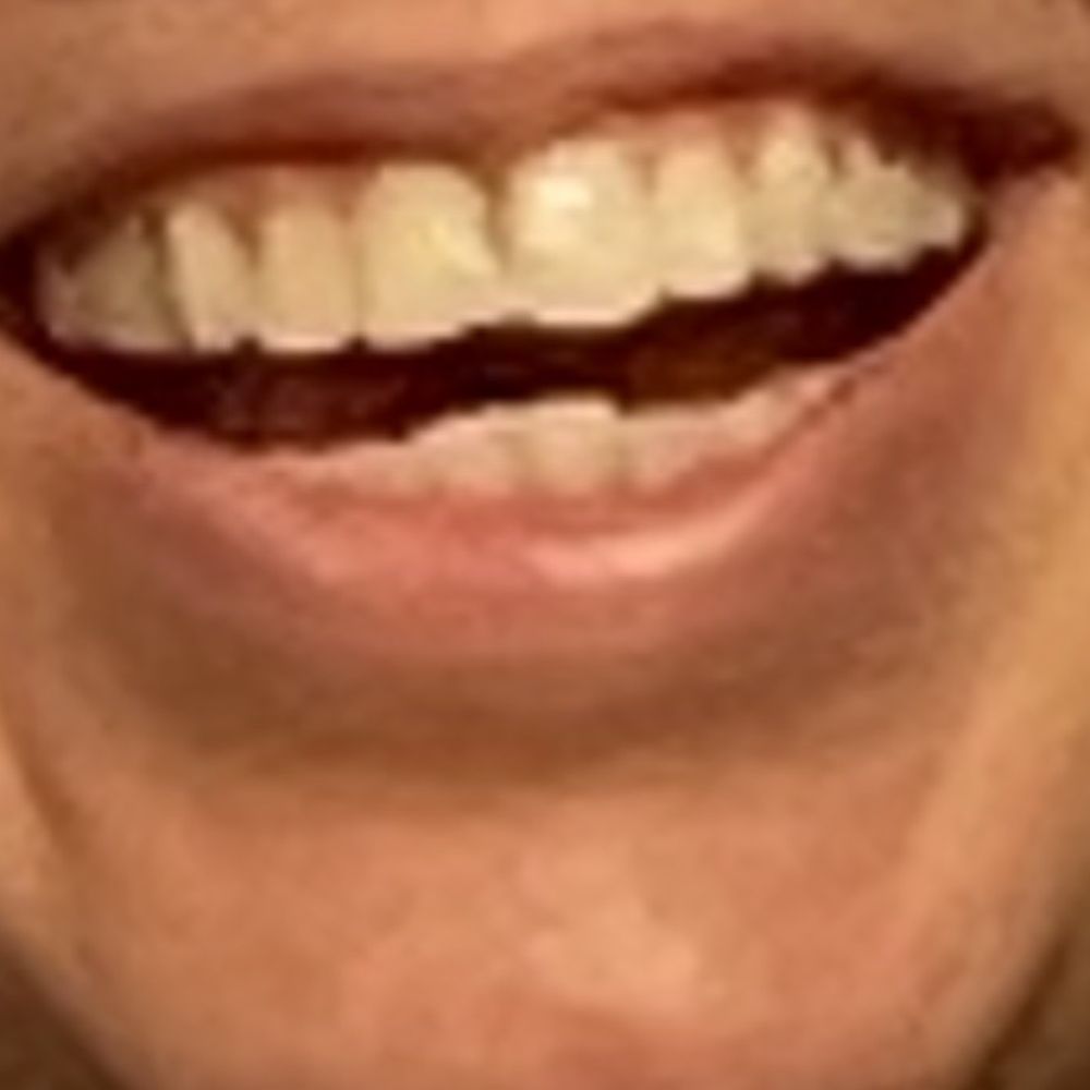 My teeth before My teeth before